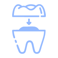 Smile Design